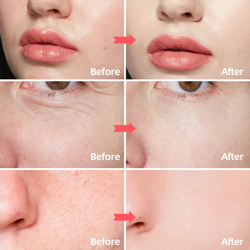 Skin Care Retinol Facial Moisturizer Hydrating with Hyaluronic Acid, Skincare Face Cream to Reduce Wrinkles Powerful Day and Night Anti-Aging Cream