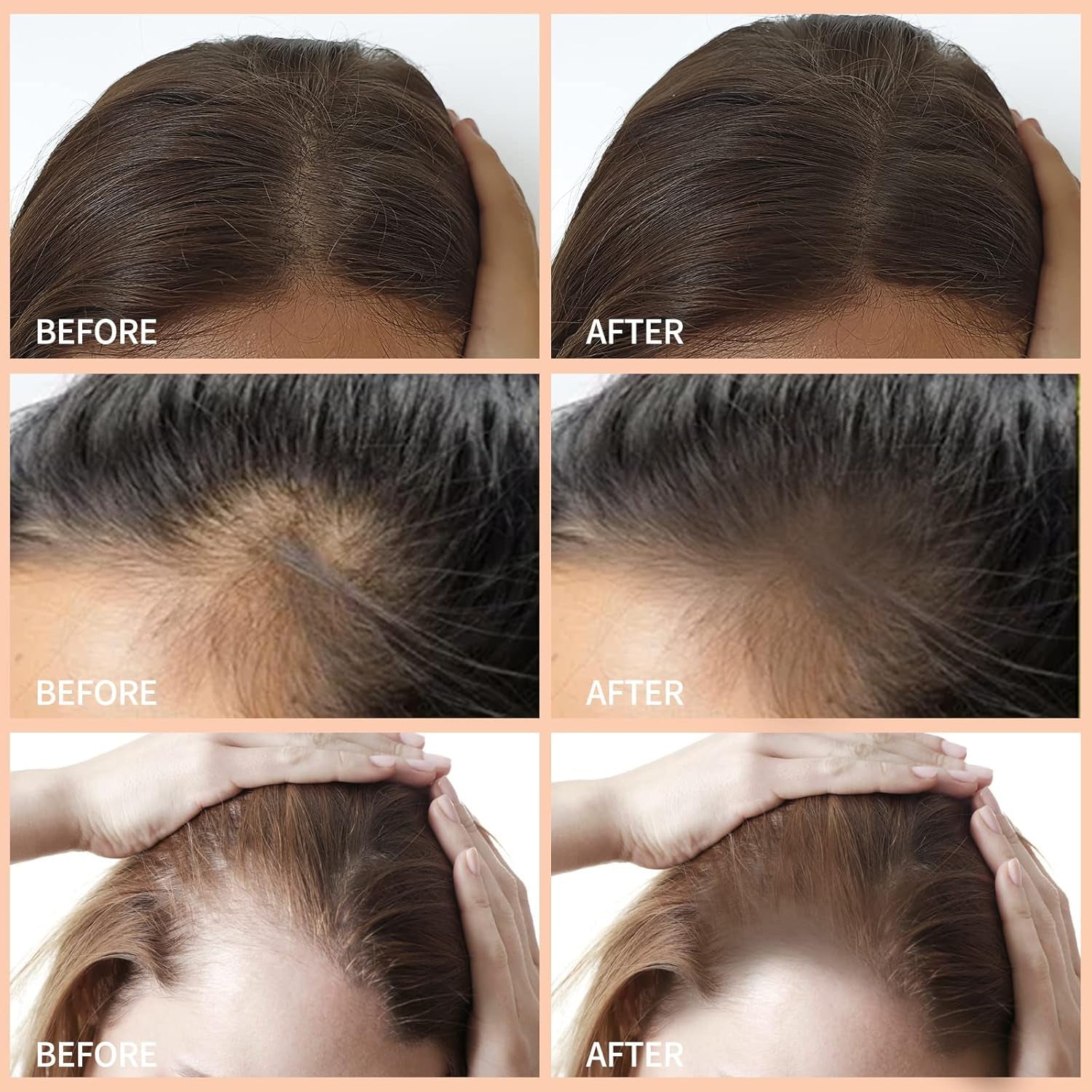 Hair Shadow Kit, Root Touch up Color Cover, Temporary Concealer with Brush for Gray Hair